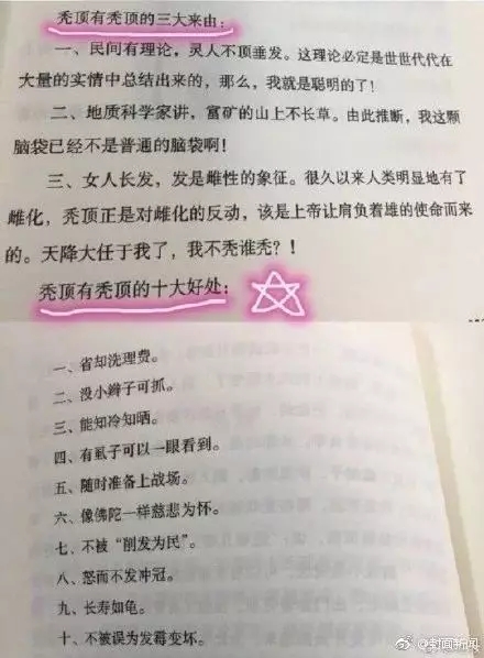 原来秃顶也不一定有坏处的，