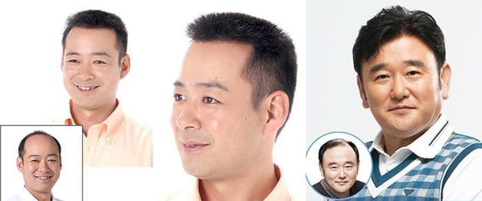 西安织发补发哪家好？增发需要多少钱？