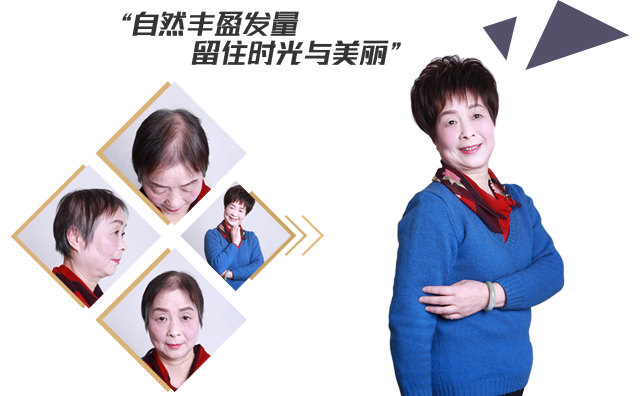 织发补发